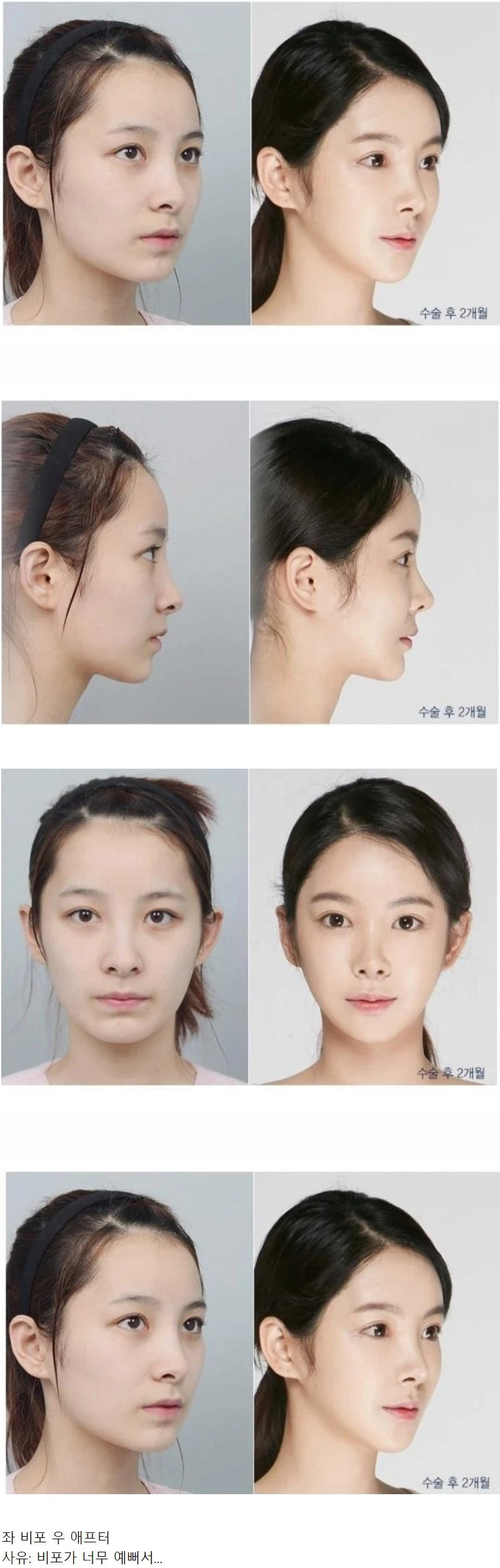 사람들이 너무 안타까워한 성형외과 광고 사진